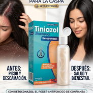 Shampoo de Ketoconazol - Img 56952628