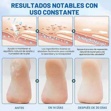 Barra de Cuidado de Pies — Urea 60% + Ácido Salicílico 2% - 5/8