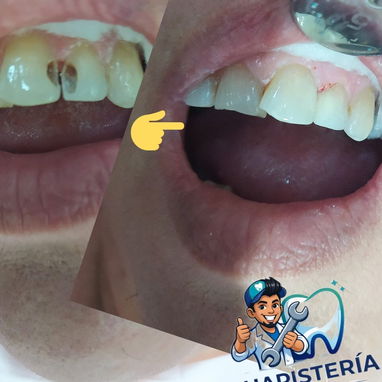 Diseño d sonrisa - 9/10