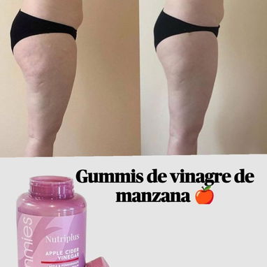 🍎 Gomitas Vinagre de Manzana Farmasi Nutriplus | Digestión Metabolismo Bienestar | 60 Gomitas - Img 121057867