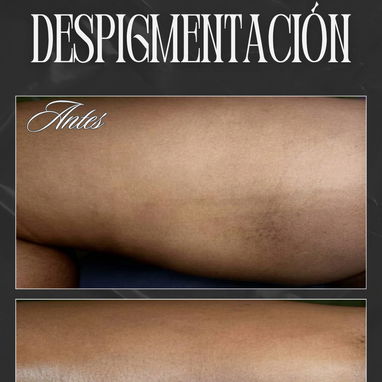 Spa_leydis 🪷 ubicado en Marianao donde resaltamos tu belleza de forma natural - 8/9