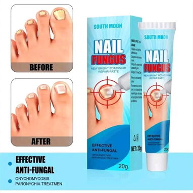CREMA PREVENTIVA PARA UÑAS CON ONICOMICOSIS 1900$ - Img 120192882