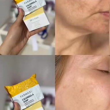 🌼✨ ¡Dale a tu piel el cuidado que merece con el jabóndeCaléndula! ✨🌼 - Img 123486660
