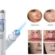 UNICO EN REVO➡️PLUMA PARA ELIMINAR CICATRICES CON FOTOTERAPIA UV - Img 54129711