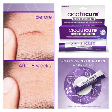 Cicatricure gel y crema - Img 109920018