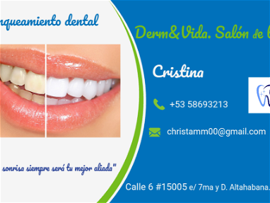 Blanqueamiento dental - Img main-image