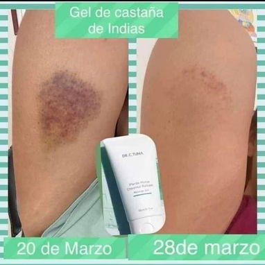 GEL DE MASAJE DR C TUNA HORSE CHESTNUT BALSAM (150ml) ORIGINAL - ALIVIO MUSCULAR - Img 125253749