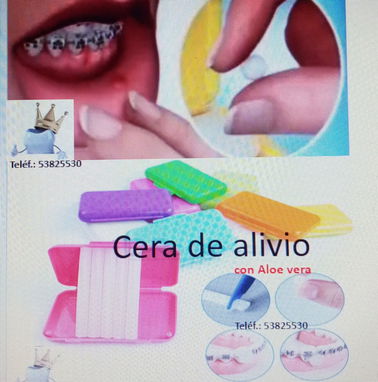 Ligas intermaxilares para tratamiento de ortodoncia - Img 76162858