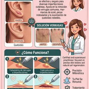 PlasmaPen/Quita verrugas/Quita queloides/Multiusos - Img 58046459