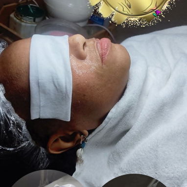 Limpieza facial profunda con Aparatologia - Img 122928359