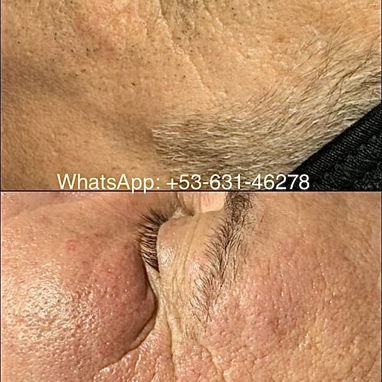 Tratamientos faciales y corporales - Img 122478659
