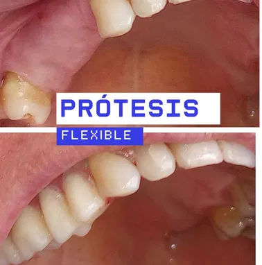 Servicios de prótesis dental - Img 96950398