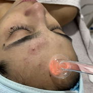 LIMPIEZA  FACIAL - Img 54984605