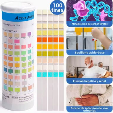 Kit medición grafica 10 parámetros en orina - Img 121465510