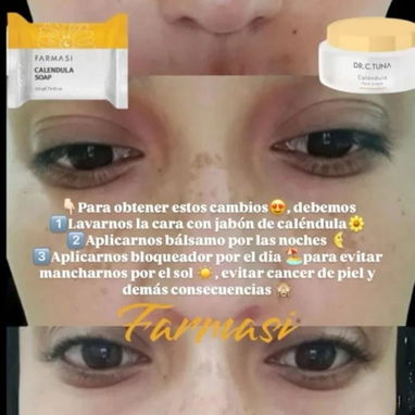 🧡OFERTAAA: DÚO ACLARANTE DE CALÉNDULA. PIEL CLARA Y PAREJA 🧡 - 2/3