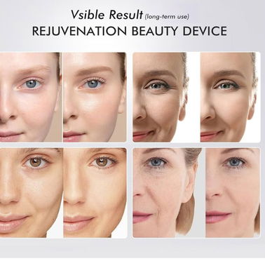 Máquina facial para estirar la piel, herramienta de masaje facial con 5 modos, absorción mejorada, levantamiento facial - Img 95243250