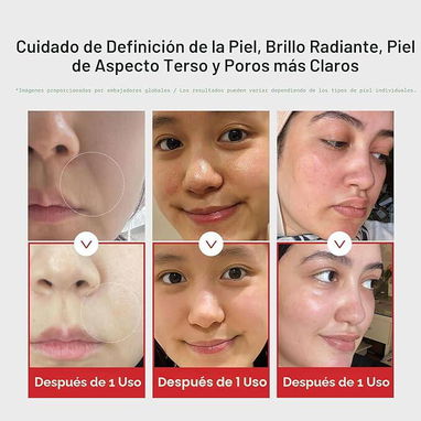 Medicube AGE-R Booster Pro 6 en 1 – Rosa - 4/5
