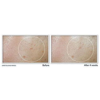 RoC Multi Correxion Even Tone + Lift Daily Moisturizer con SPF 30 (50 ml) | Con garantía | videojuegoshabana.com - Img 122989042