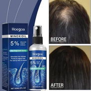 MINOXIDIL - Img 56187625