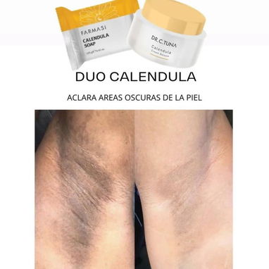 Jabón de caléndula - Img 120031543