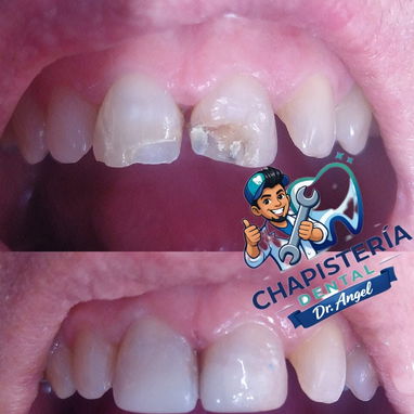 Diseño d sonrisa - 10/10