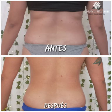 Eliminar grasa abdominal, quemador de grasa, eliminar flacidez, maderoterapia , masajes, grasa, bajar de peso - 2/2