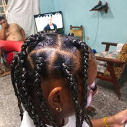 Peinados con cera, extensiones e implantes - Img 56030688