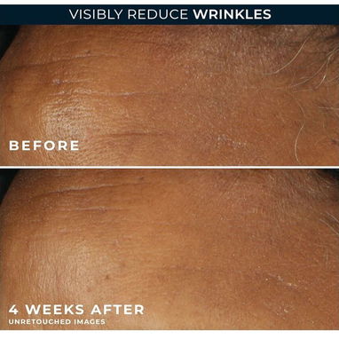 RoC Retinol Correxion Deep Wrinkle Daily Moisturizer con SPF 30 (30 ml) | Con garantía | videojuegoshabana.com - Img 123011047
