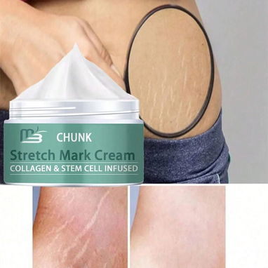 (X)  Crema para marcas de estiramiento para masaje corporal y reducción de cicatrices durante el embarazo  $7.40 - 5/6