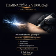 Eliminación de verrugas con fibroblast - Img 53009703