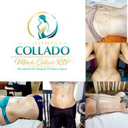 ✅ DRENAJE LINFÁTICO POST QUIRÚRGICO, MASAJES POST OPERATORIO, APARATOLOGIA ASESORÍA DOMICILIO ✅ - Img 55369872
