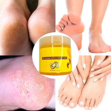🥃🌰 𝑬𝑿𝑭𝑶𝑳𝑰𝑨𝑵𝑻𝑬 𝑫𝑬 𝑷𝑰𝑬𝑺 🌰🥃🥑 💗💕 𝐏𝐑𝐄𝐂𝐈𝐎: 2900  🌟Gel Exfoliante Para Pies Con Resultados Inmedi - 2/2