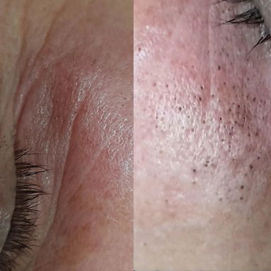 LIMPIEZA FACIAL| MASAJE RELAJANTE _ TERAPIAS CORPORALES | PODO TERAPIA - Img 123378159
