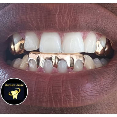 ✨💯Karuko Smiles 🤩✨Sonríe con estilo, Brilla con 🥇✨ Ponte pill@ 😁💪🏻 - 7/10