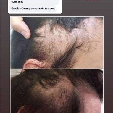 Aceite de romero de la Influencer Amanda Camaraza - Img 122127966