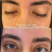 Cejas depilación con pinza - Img 57786891