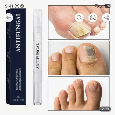 Fuera Uñas Enfermas en Manos y Pies, Lápiz Seralia Anti Hongos - 2/8