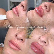 OFERTA DE VERANO EN SPA_LEYDIS MARIANAO - Img 56073618