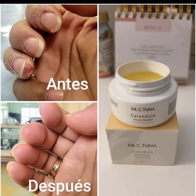 Dúo Caléndula Aclarante, cicatrizante, para eliminar manchas - Img 116944275