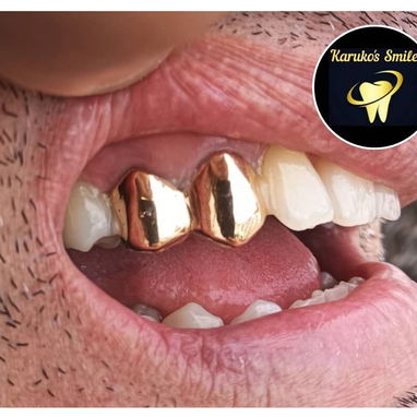 ✨💯Karuko Smiles 🤩✨Sonríe con estilo, Brilla con 🥇✨ Ponte pill@ 😁💪🏻 - 3/10