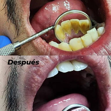 No se lo pierda , servicio de estética dental - Img 93032211