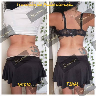 Eliminar grasa abdominal, quemador de grasa, eliminar flacidez, maderoterapia , masajes, grasa, bajar de peso - Img 112244913