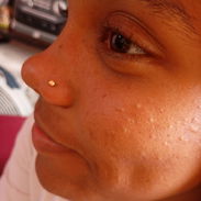 Perforaciones nariz, orejas a bebés y adultos con aretes Antialérgicos medicinales - Img 53721222