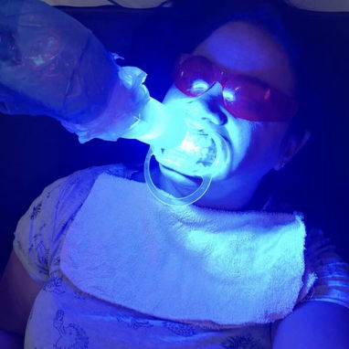 Blanqueamiento y limpieza dental - Img 127132747