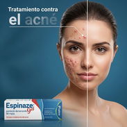 Tratamiento para el Acné (Peróxido de Benzoilo al 5 %) - Img 55192294