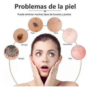 Cauterizador Quita Verrugas, Manchas, Pecas 58757374 - Img 76586174