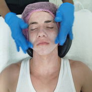 Tratamientos anti acné manchas y arrugas y limpieza facial profunda - Img 54875112
