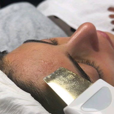 Limpieza Facial Profunda a domicilio - Img 118250133