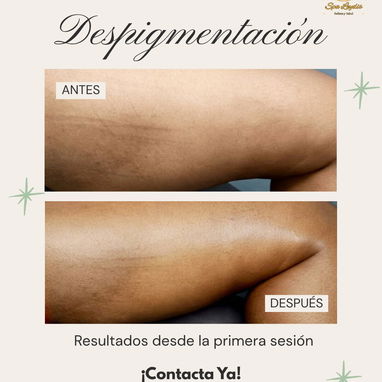 OFERTAS DE VERANO EN SPA_LEYDIS . MARIANAO. CAMBIOS DESDE LA 1RA SESIÓN. - Img 124016074