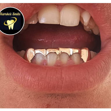 ✨💯Karuko Smiles 🤩✨Sonríe con estilo, Brilla con 🥇✨ Ponte pill@ 😁💪🏻 - 9/10